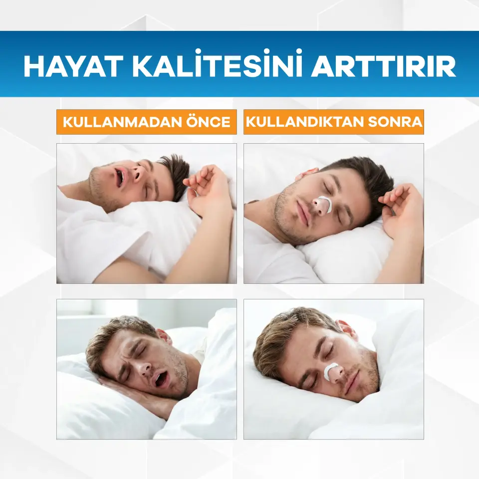 Eldi Manyetik Burun Açıcı Bandı - 30 Çift Beyaz Başlama Seti