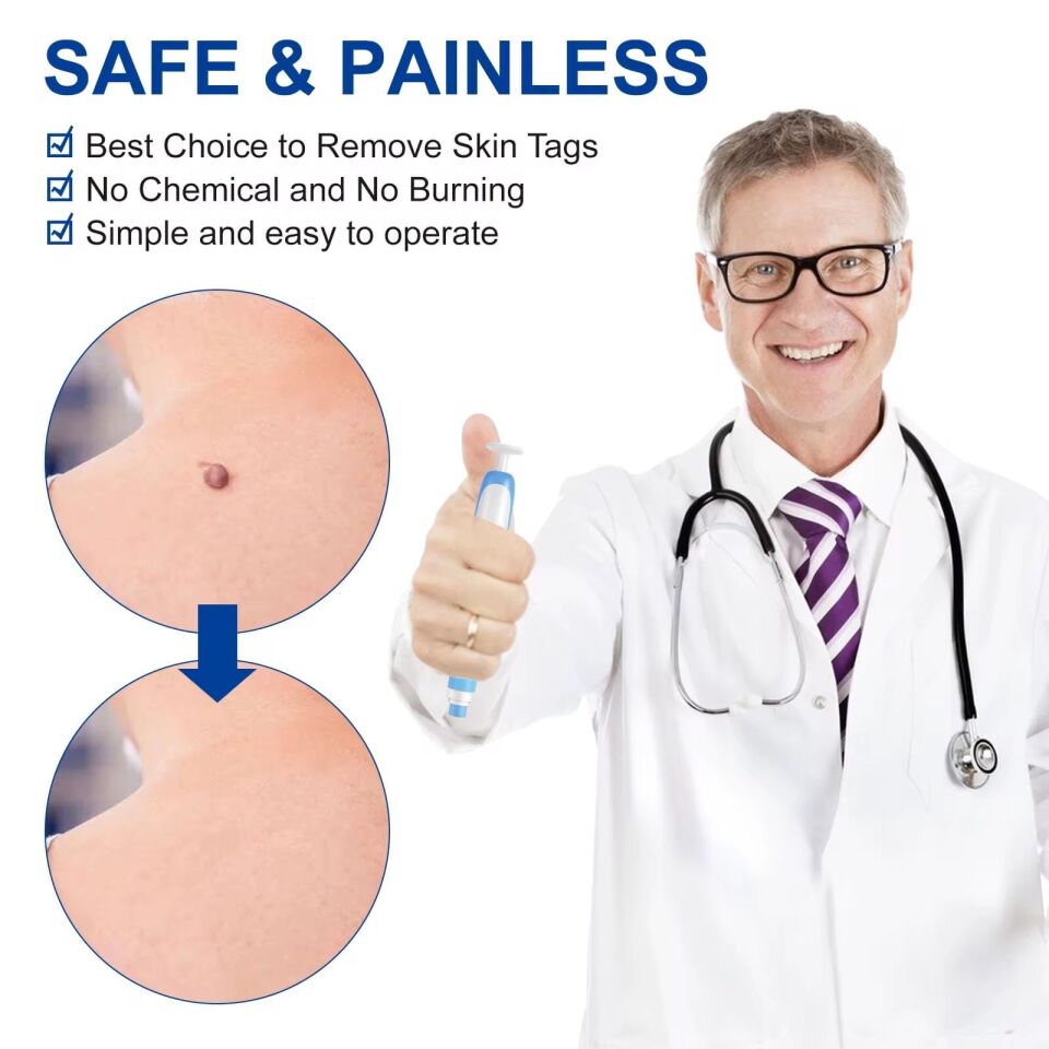 Et Beni Düşürme Aparatı – Acısız Ev Tipi Et Beni Temizleme Seti (4–9 mm)