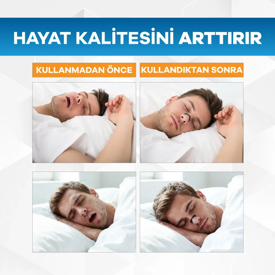 Eldi Manyetik Burun Açıcı Bandı - 30 Çift Siyah Başlama Seti