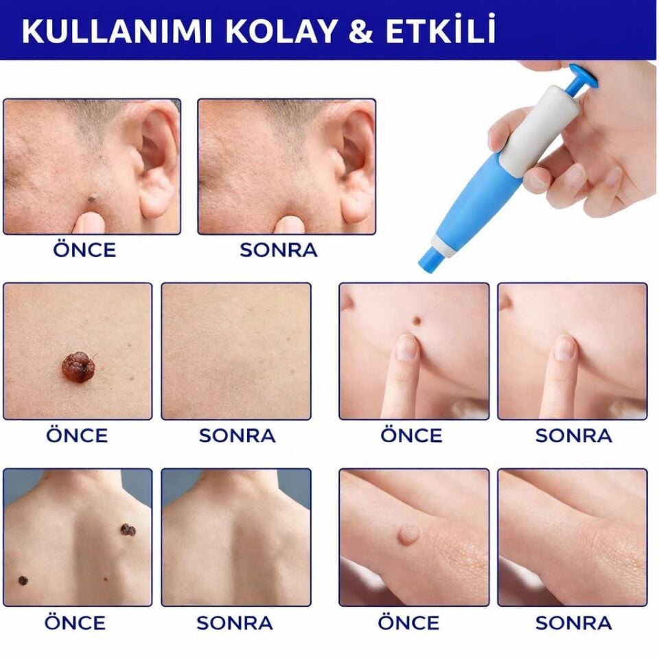 ELDİ Et Beni Bantlama Seti 2'si 1 Arada