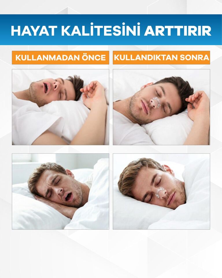 Eldi Manyetik Burun Açıcı Şeffaf Başlangıç Seti (30 Çift Yapışkan Bant)